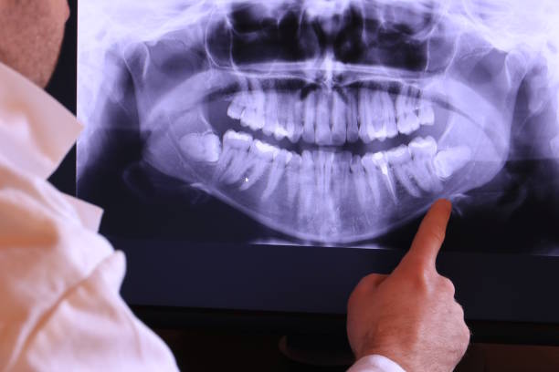 Trusted NC Emergency Dental Service Experts